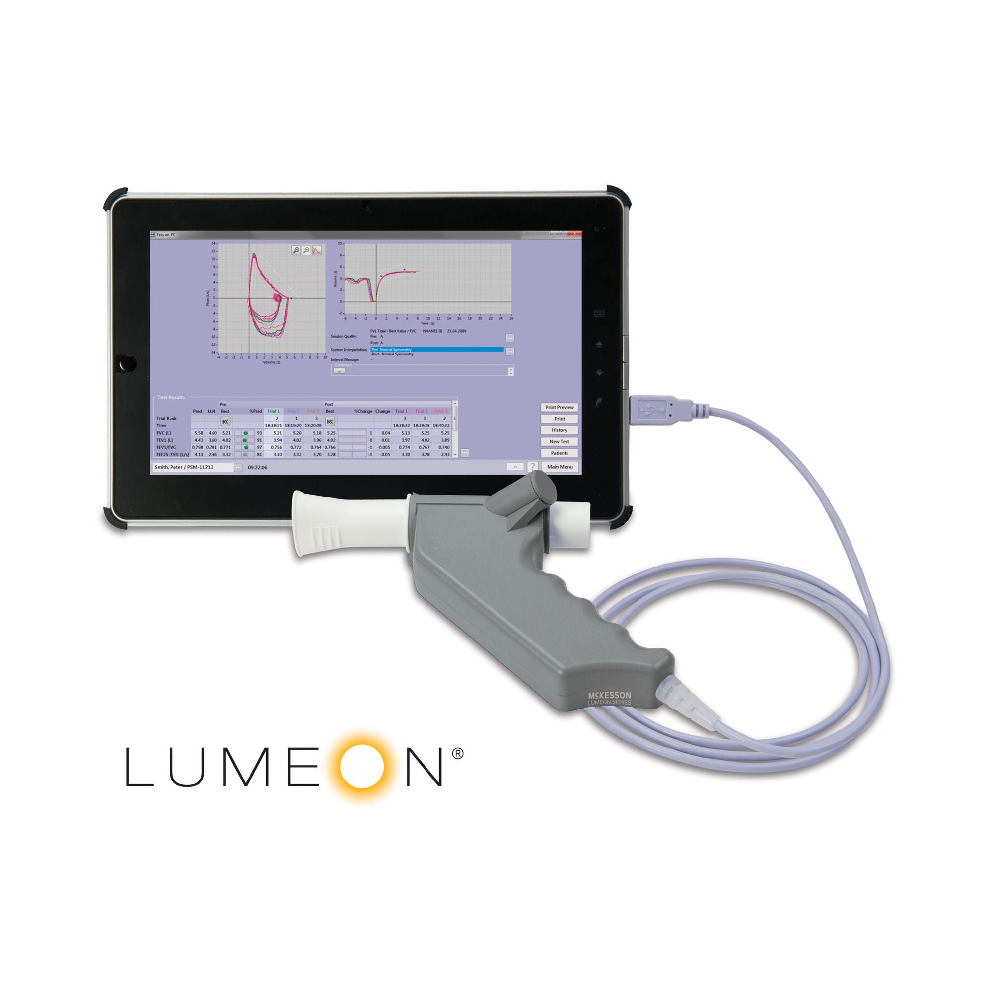 McKesson Brand - 796 McKesson LUMEON™ PC Spirometer