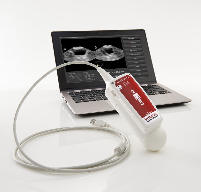 Vitacon - 100525G1 Bladder Scanner VitaScan LT Probe and Software