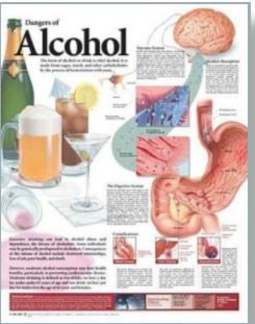 Wolter Kluwer Health Inc - 9780781782395 Anatomical Chart Dangers of Alcohol 20 X 26 Inch Heavy Paper Grommets Laminated