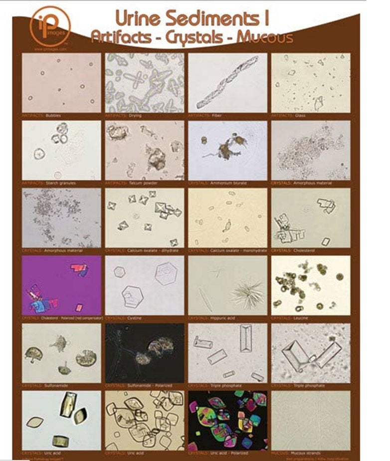 Market Lab Inc - 1888 Poster and Binder Cards Urine Sediments 19 X 24 Inch