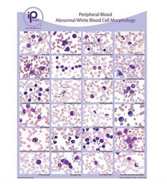Market Lab Inc - 7813 Anatomical Chart Blood Abnormal WBC Morphology Laminated