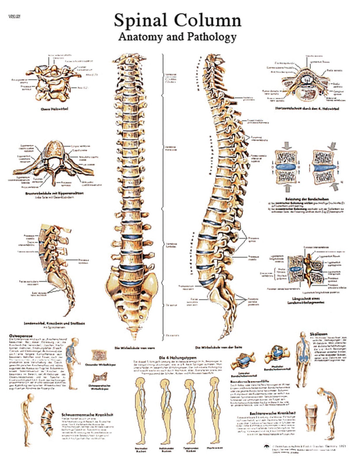 Fabrication Enterprises - 12-4622L Anatomical Chart Spinal Column 20 X 20 Inch Laminated