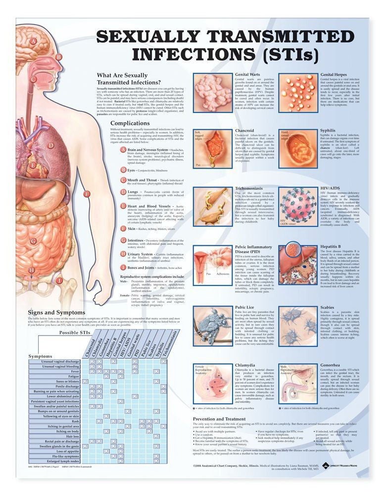 Wolter Kluwer Health Inc - 9781587798498 Anatomical Chart Sexually Transmitted Infections (STIS) 20 X 26 Inch Heavy Paper Grommets Laminated