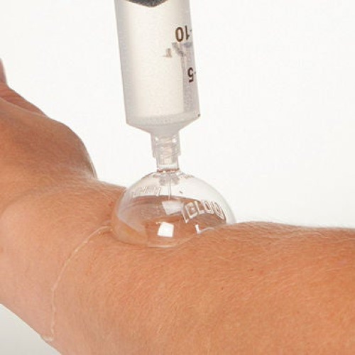 Health Care Logistics - 10267 Wound Irrigation Shield Disposable, Plastic, Sterile For Luer Lock Syringe