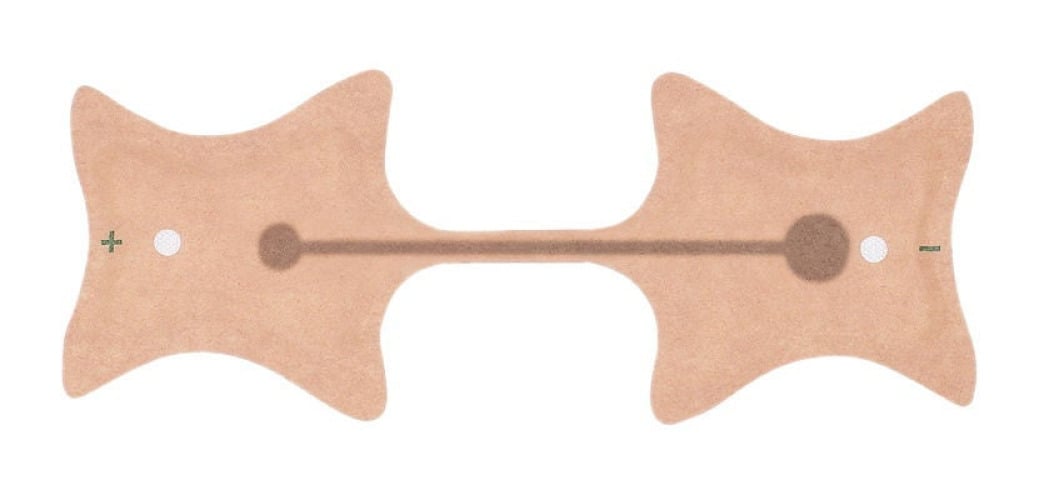 Fabrication Enterprises - 13-5224 Iontophoresis Electrode Kit IontoPatch® Extra Strength™ 1.2 to 1.6 cc Fill Volume 6/Pk