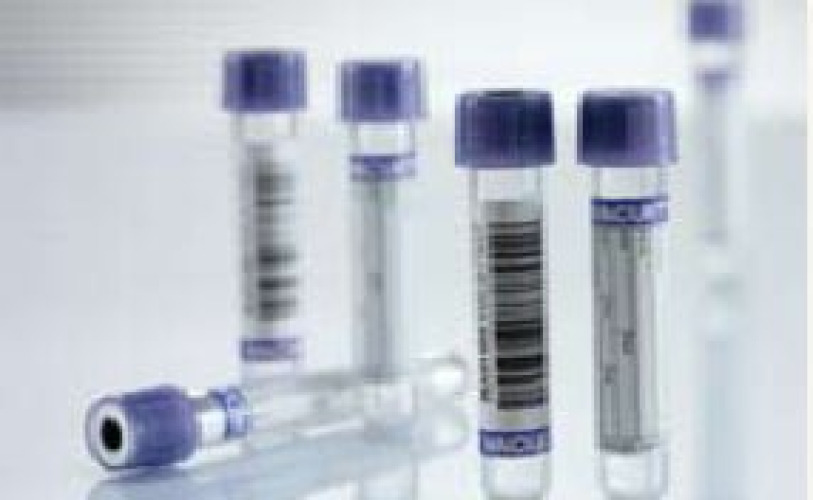 Greiner Bio-One - 454021 Vacuette® Venous Blood Collection Tube