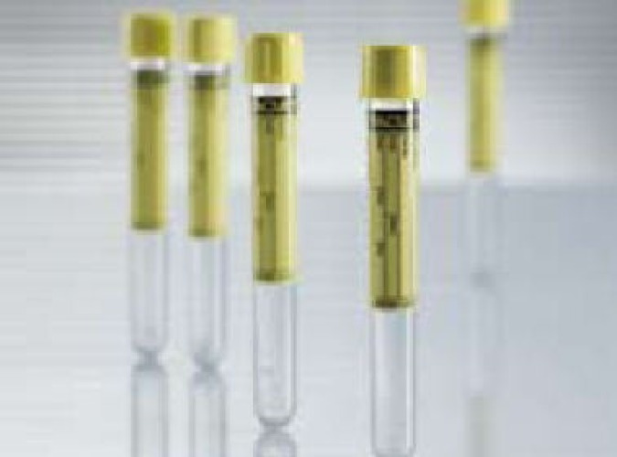 Greiner Bio-One - 455028 Vacuette® Urinalysis Tube