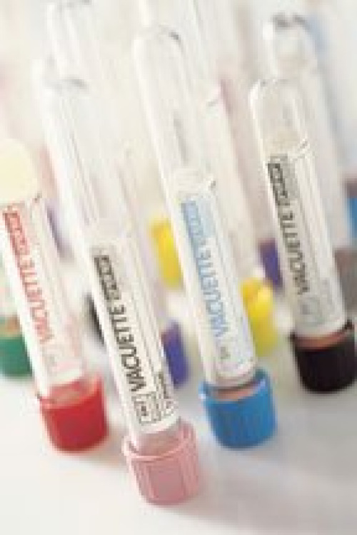 Greiner Bio-One 456002 - Vacuette® Venous Blood Collection Tube, 6 mL, 13 x 100 mm - 50/Pack, 1200/Case