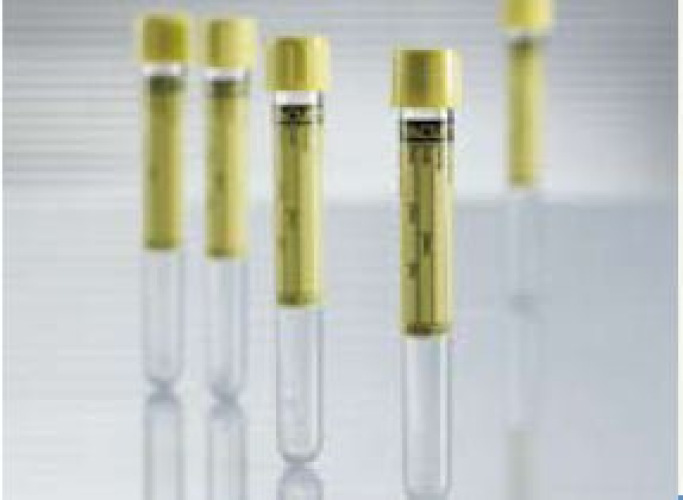 Greiner Bio-One - 456007 Vacuette® Urinalysis Tube