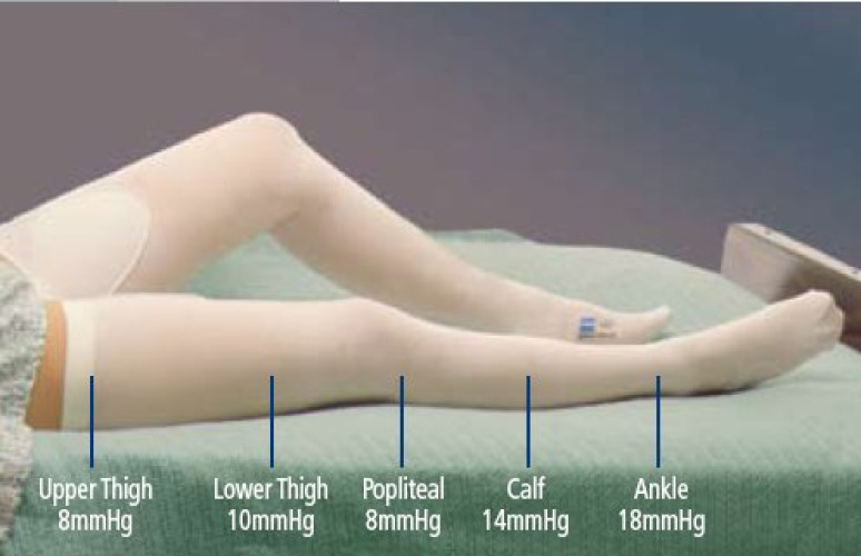 Cardinal 7470LF - T.E.D.™ Knee High Anti-embolism Stockings, 2X-Large / Regular - 1/Pair, 12/Carton