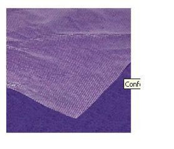 Smith & Nephew 5955044 - Conformant 2 Wound Contact Layer Dressing, 4 x 4 Inch - 1/Each, 48/Case