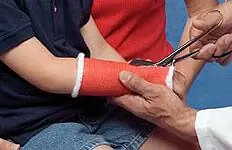 BSN Medical - 6602 Cast Tape Delta-Cast® Conformable 2 Inch X 12 Foot Polyester White