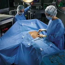 O&M Halyard Inc - 89233 Abdominal Drape Laparoscopic / Abdominal Drape 100 W X 76 W X 124 L Inch Sterile