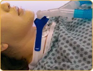 Marpac - 900D Vent Circuit Anti-Disconnect Device For Trach Ties® Tracheostomy Tube