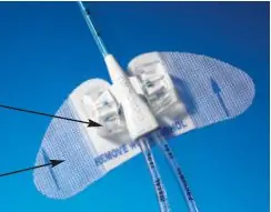 BD - VCDC Statlock® PICC Plus Central Venous Catheter Stabilization Device