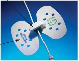 BD - VUPD1214 StatLock® Stabilization Device