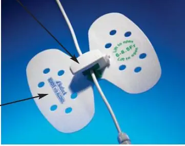BD - VUPD1416 Statlock® Universal Plus Drainage Catheter Stabilization Device