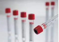 Greiner Bio-One - 455092 Vacuette® Z Serum Clot Activator Venous Blood Collection Tube