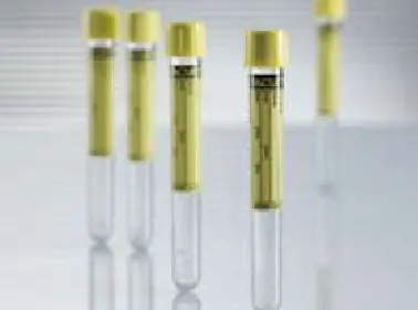 Greiner Bio-One - 455028 Vacuette® Urinalysis Tube