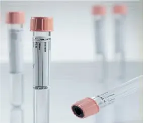 Greiner Bio-One - 456067 Vacuette® Venous Blood Collection Tube