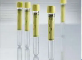 Greiner Bio-One - 456007 Vacuette® Urinalysis Tube