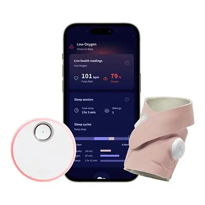 Owlet Baby Care Inc - BM06N20MCJ Owlet® Dream Sock Smart Baby Monitor