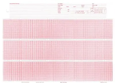 Nissha Medical Tech - 7G10869445 Recording Chart Paper Burdick™ Roll Red Grid
