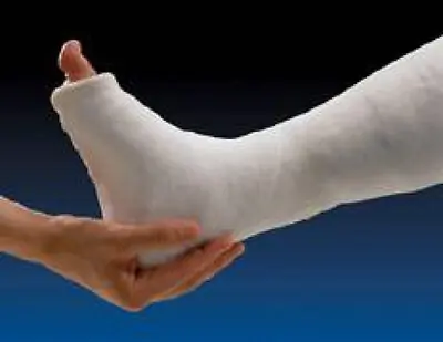 BSN Medical - 30-3048 Plaster Splint Gypsona® HP 4 X 15 Inch Plaster of Paris White