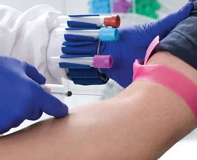 Market Lab Inc - 5000 Tube Jockey Wristband / Holder Set For Holding 13 - 16 mm Tubes