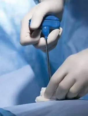 BD - BK1000SP Biopsy Tray Safe-T™ Plus Bone Marrow Without Needle