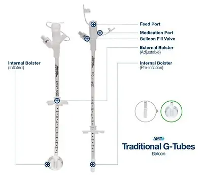 Applied Medical Technology Inc - 7-1410 Y-Port Balloon Gastrostomy Tube Kit AMT 14 Fr. Silicone Sterile