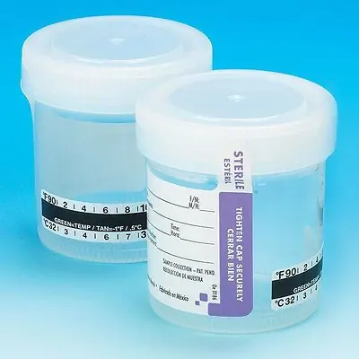 Globe Scientific - 6236 Globe Scientific Specimen Container with Temperature Strip