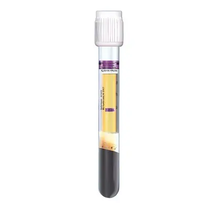 BD - 362799 BD Vacutainer® PPT™ Molecular Diagnostic Tube K2 EDTA / Separator Gel Additive 8.5 mL BD Hemogard™ Closure Plastic Tube
