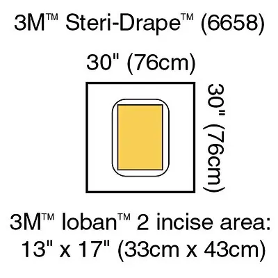 Solventum Corporation - 6658 3M™ Steri-Drape™ Sterile Large Pouch Surgical Drape