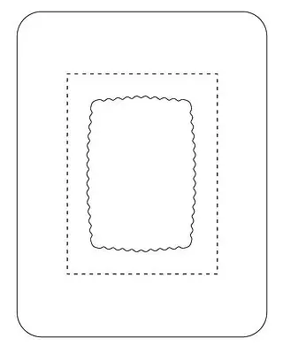Medline - SV80XT SorbaView® 2000 Transparent Film Dressing with Pad