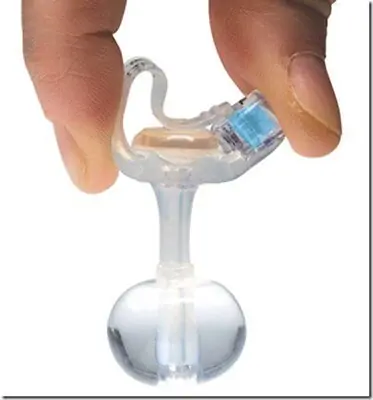 Applied Medical Technology Inc - M1-5-1630 Mini One® Low Profile Balloon Button Gastrostomy Tube Kit