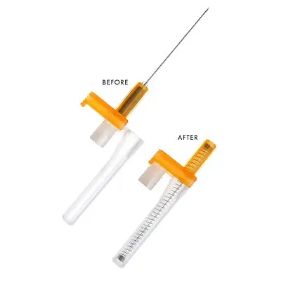 Retractable Technologies - 85011 Safety Hypodermic Needle EasyPoint® 1-1/2 Inch Length 25 Gauge Regular Wall Retractable Safety Needle