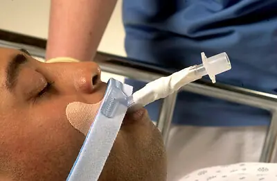 Dale Medical Products - 270 Stabilock™ Endotracheal Tube Holder