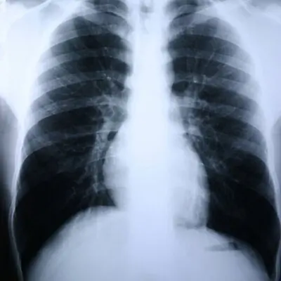 McKesson Brand - 55BTL Clear Choice™ Performance X-Ray Film