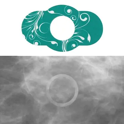 PDC Healthcare - SDG-MSD3 Radiology Skin Marker Spee-D-Line™ Swirl Collection™ Circle Mole