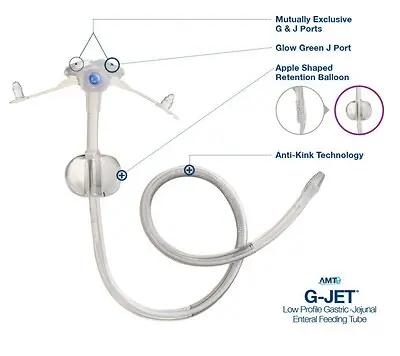 Applied Medical Technology Inc - GJ-1430-45 Low Profile Gastric-Jejunal Enteral Feeding Tube G-JET® 14 Fr. 3.0 / 45 cm Tube Silicone